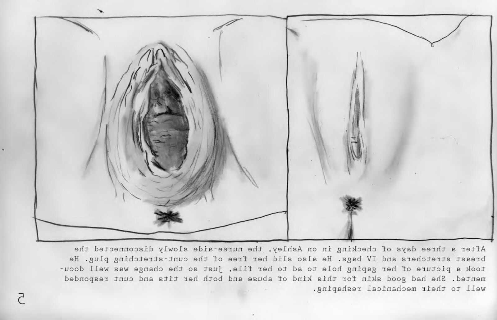 Seins reconstruits